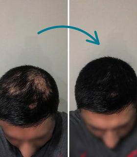 Before and after applying Hair Genetics Hair Fibres in Black