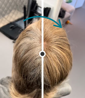Before and after using Hair Genetics Light Brown Root Cover Up to conceal grey roots on dark blonde hair