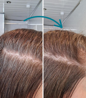 Before and after applying Hair Genetics Hair Fibres in Black