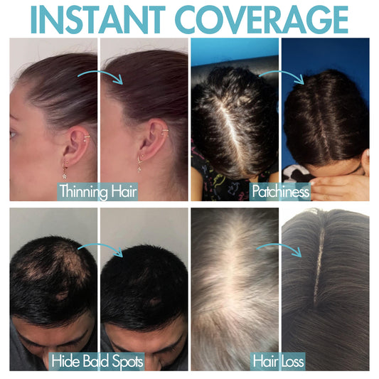 Hair Fibres – Conceal Thinning Hair Instantly, Natural-Looking Colors