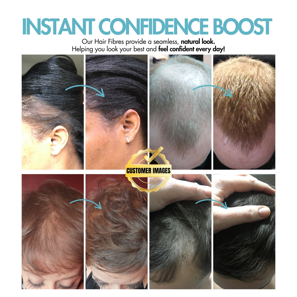 Hair Fibres – Conceal Thinning Hair Instantly, Natural-Looking Colors