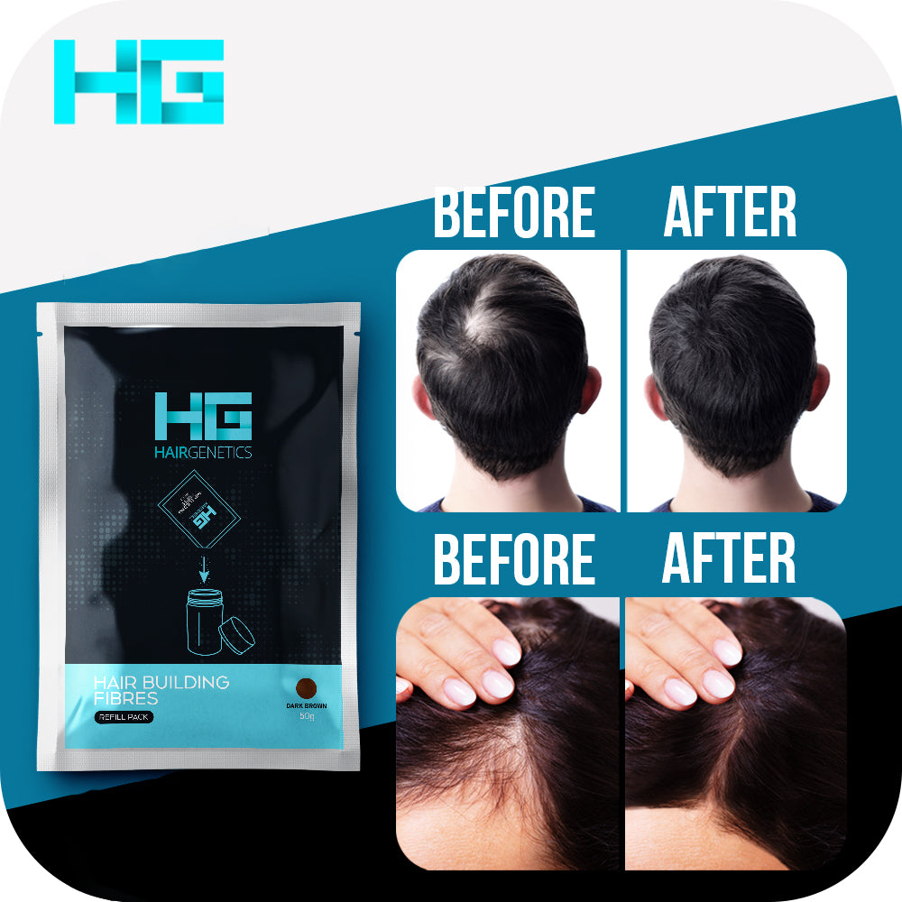 Hair Fibres Refill Pack – Natural-Looking Coverage for Thinning Hair
