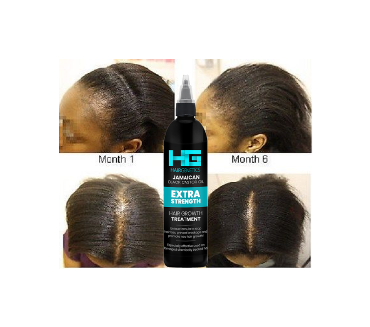 Hair Genetics Jamacian Black Castor Oil Extra Strength Hair Growth Treatment
