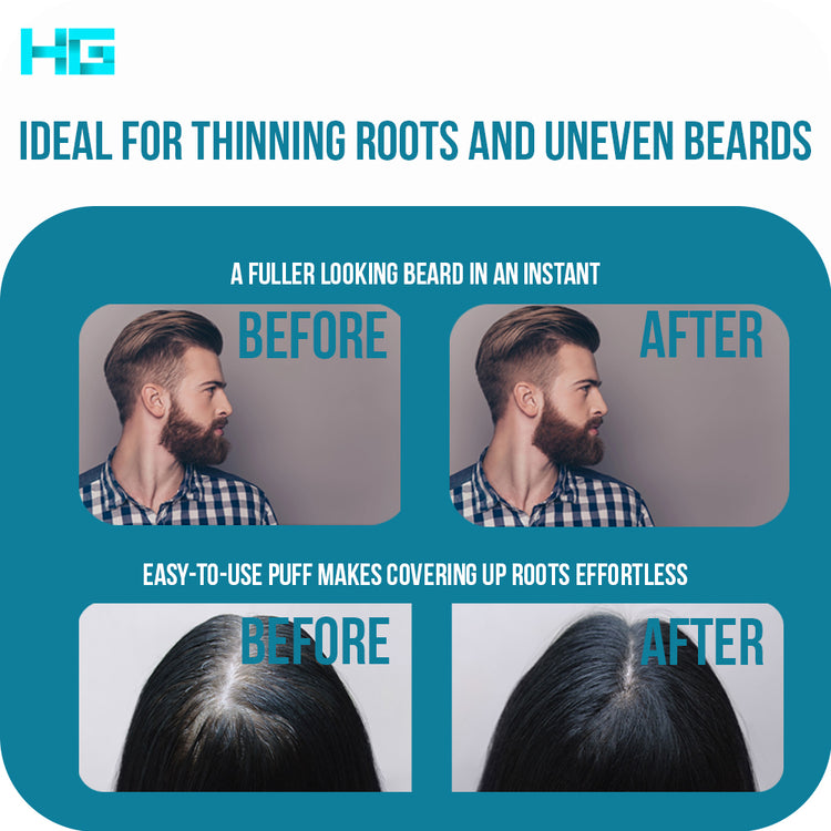 Hair Genetics Hairline Powder-Instant Coverage of Bald Spots and Grey Roots-Thickens Beards Root Concealer with Puff